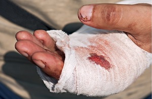  car accident injuries symptom hand injury
